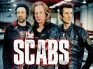 The Scabs
